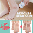 idrop Foot Relief Pedicure Dead Skin Callus Remover Skin Grinding Peeling Rechargeable Device
