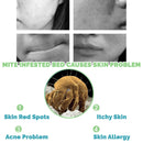 idrop [ 300ML ] Anti Mite Removal Liquid  Non Toxic Spray Remover